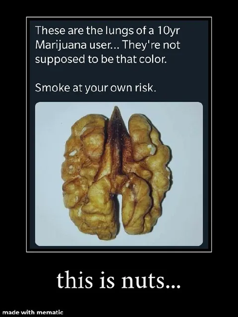 This Is Nuts Brain Meme