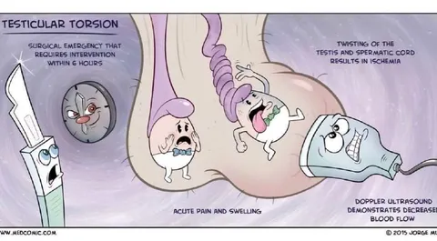 Testicular Torsion Medical Comic