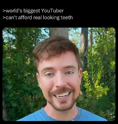 World's Biggest YouTuber Teeth