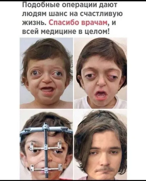 Спасибо врачам за операции