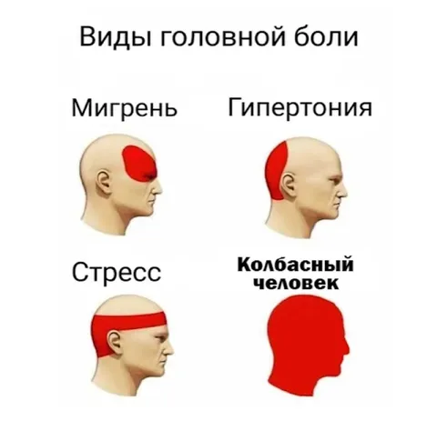 Виды головной боли