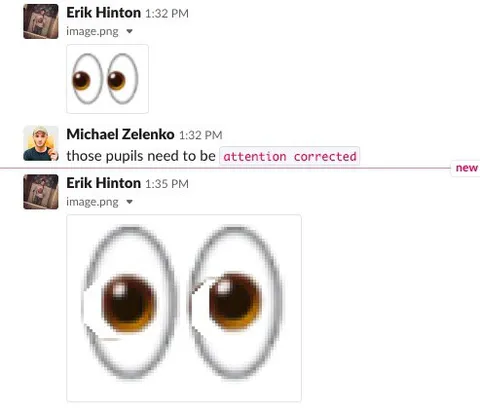 Those Pupils Need Attention Corrected