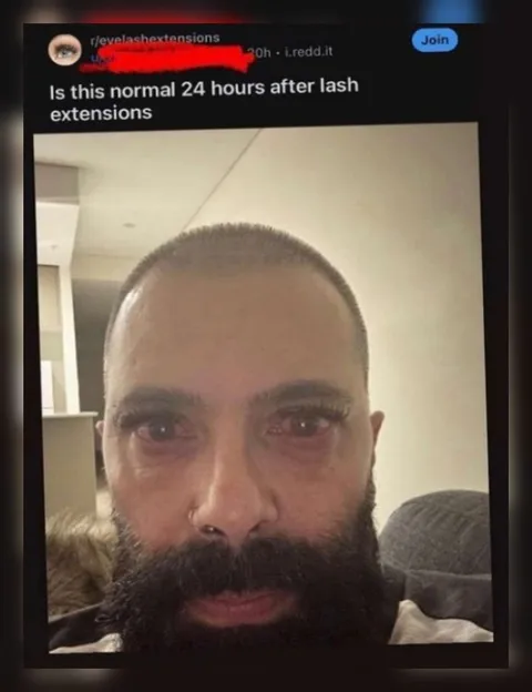 24 Hours After Lash Extensions