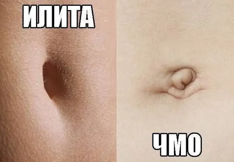 Илита против чмо