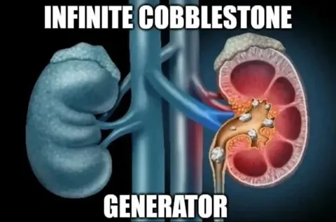 Infinite Cobblestone Generator