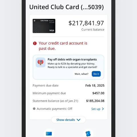 Pay Off Debts With Organs