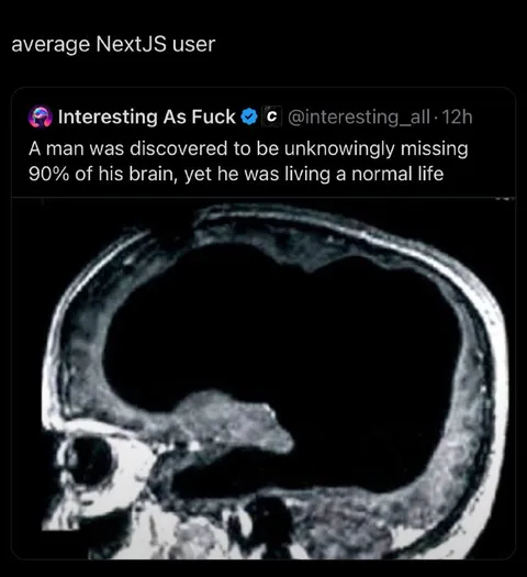 Average NextJS User Brain Scan