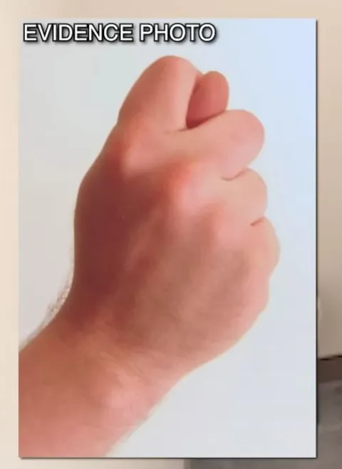 Evidence Photo Hand