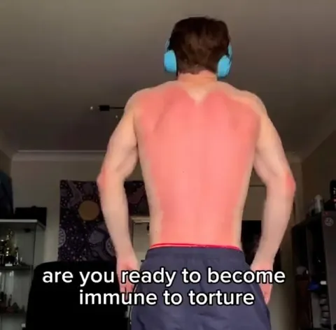 Immune to Torture