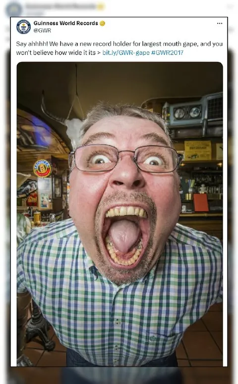 Largest Mouth Gape Record