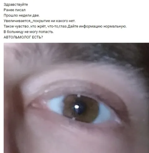 Автольмолог для странного глаза