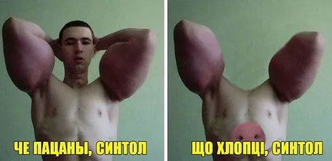 Пацаны, синтол