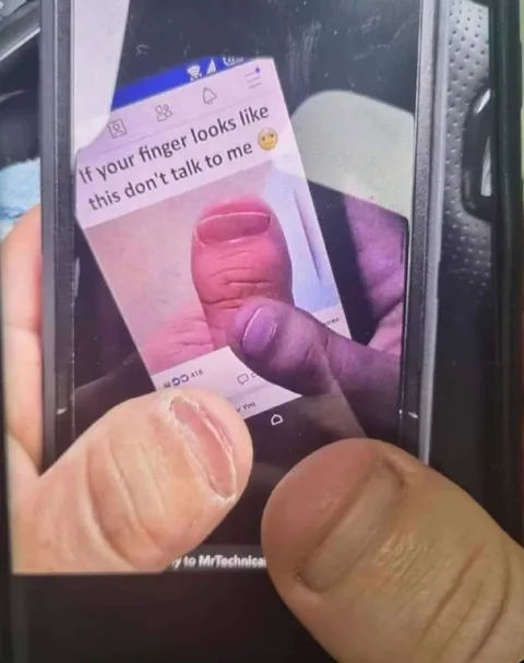 Finger Looks Like This