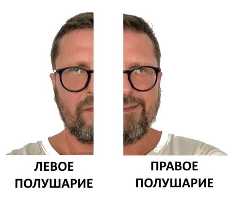 Левое и правое полушарие