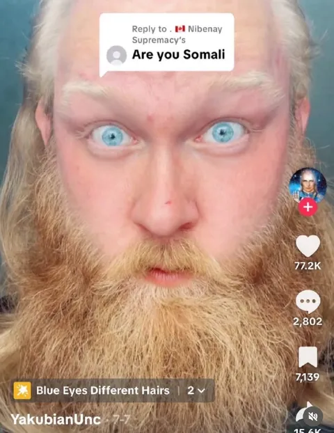 Are You Somali Reaction