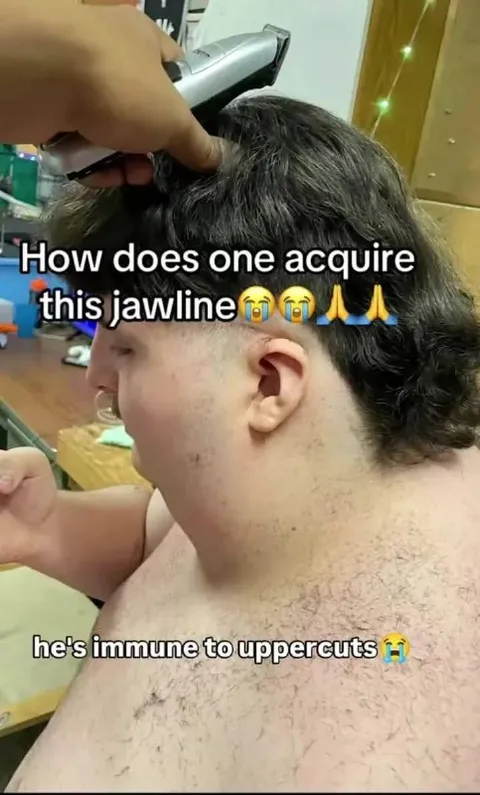 Immune to Uppercuts Jawline