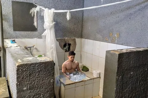 Криотерапия в бедной ванной