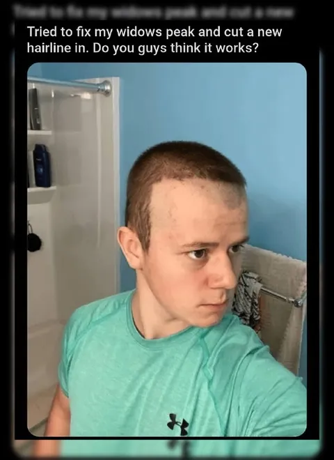 Trying to Fix a Widow's Peak