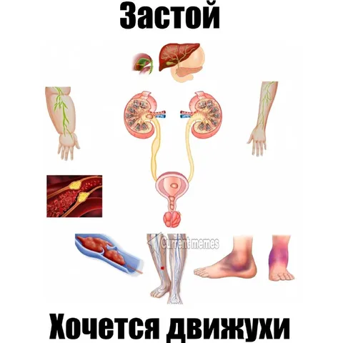 Застой хочется движкухи