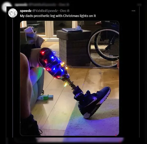 Dad's Christmas Light Prosthetic Leg