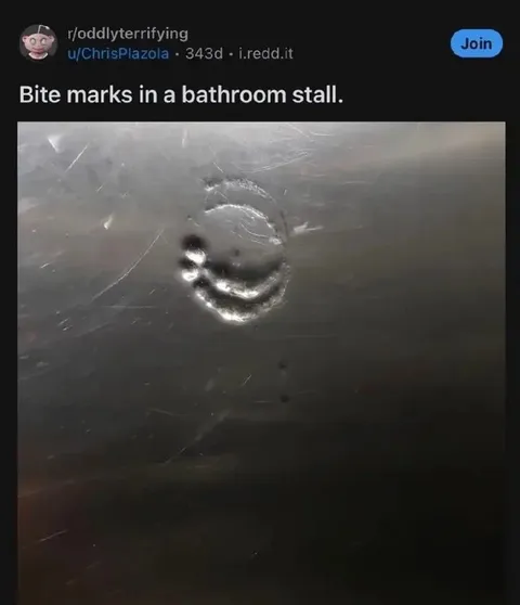 Bite Marks in a Bathroom Stall