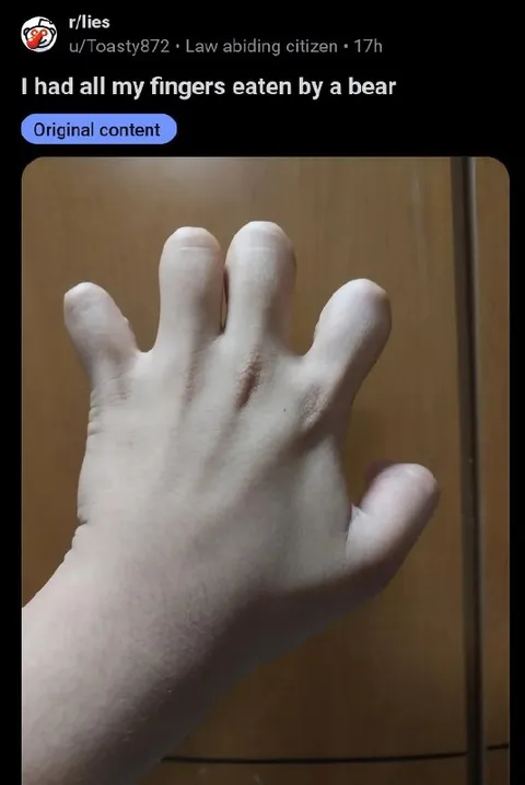 Bear Ate All My Fingers