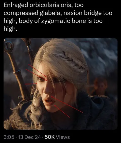 Ciri's Anatomical Facial Critique