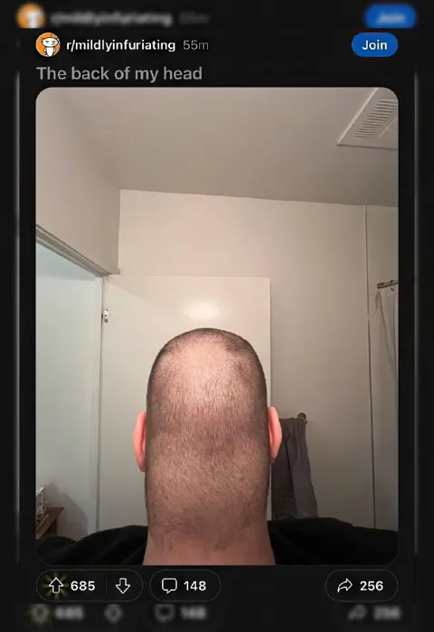 The Back of My Head