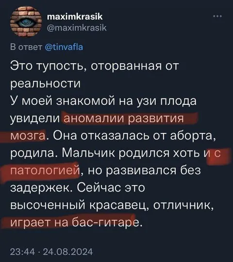 Аномалии развития мозга
