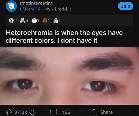 Heterochromia Without Heterochromia