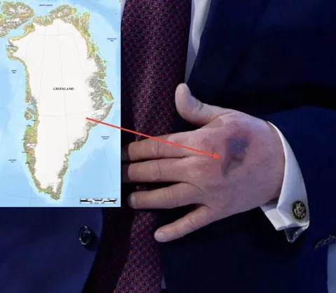 Greenland bruise map