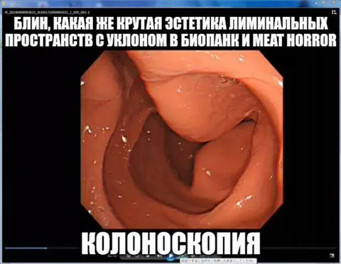Колоноскопия как эстетика лиминальных пространств