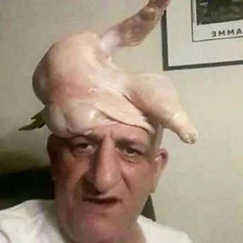 Мужчина с курицей на голове