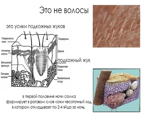 Это не волосы, а усики жуков