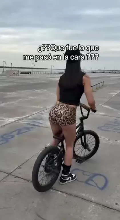 ¿Qué fue lo que me pasó en la cara?