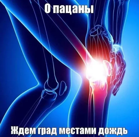 О пацаны, ждём град