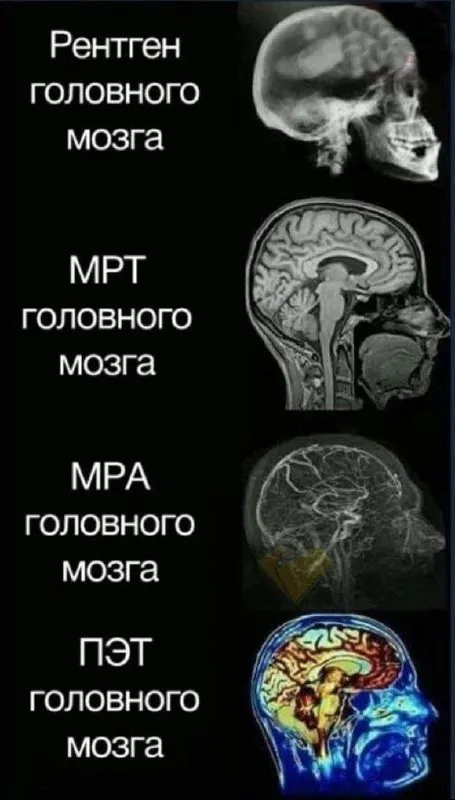 Виды обследования головного мозга