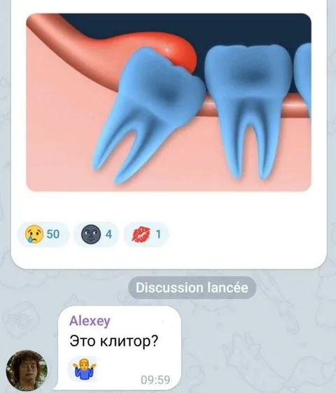 Это клитор?