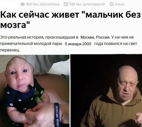 Как живёт мальчик без мозга