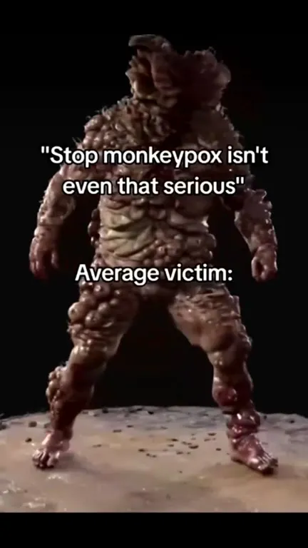Average Monkeypox Victim