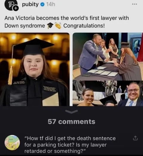 Lawyer With Down Syndrome