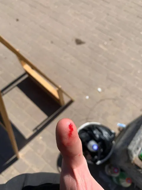 Палец после серрейтора