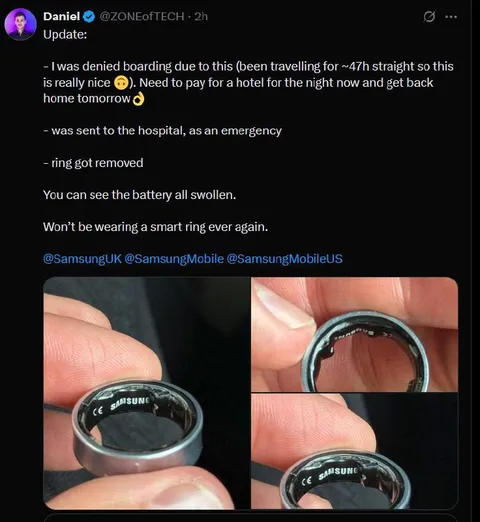 Swollen Smart Ring Battery