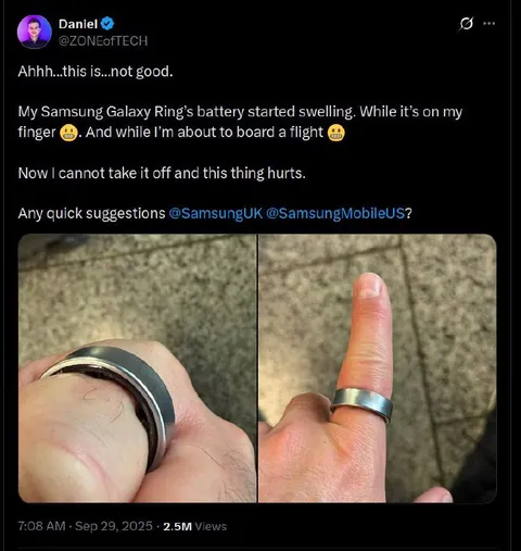 Swollen Samsung Galaxy Ring