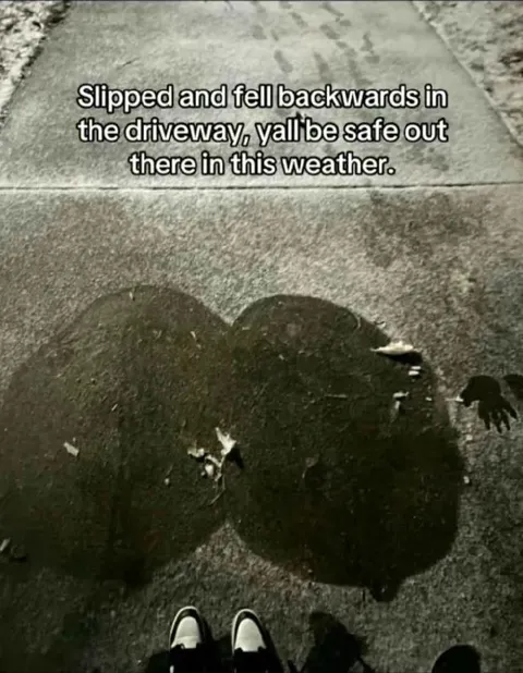 Slipped in the Driveway