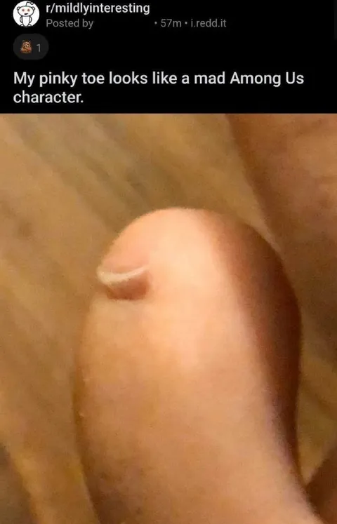 Pinky Toe Among Us