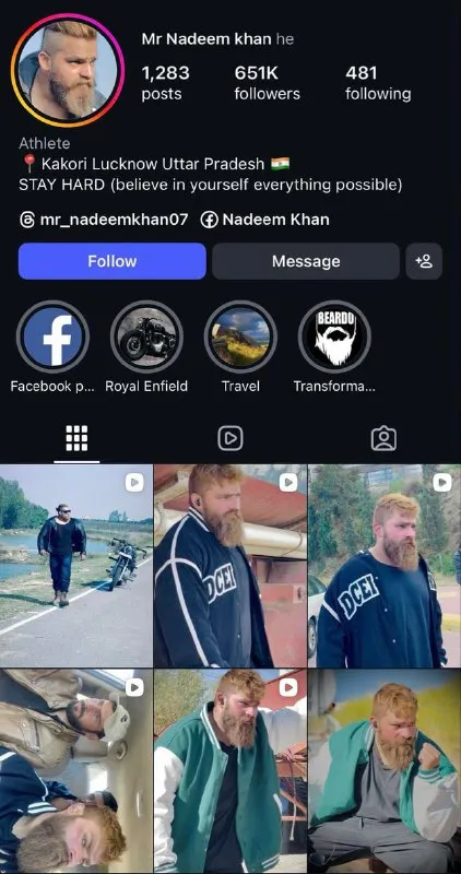 Bearded Man Transformation Profile