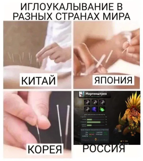 Иглоукалывание в разных странах