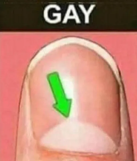 GAY Nail Close-Up