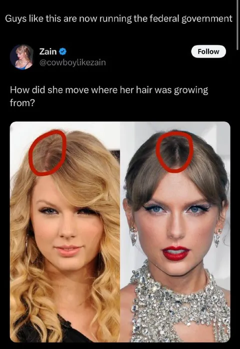 Taylor Swift Hairline Transformation